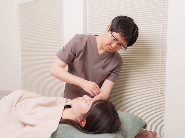 美容鍼灸の施術を行う様子。
